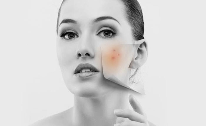 Không khí lạnh tràn về chị em nào bảo không cần bôi kem chống nắng thì nhầm to rồi