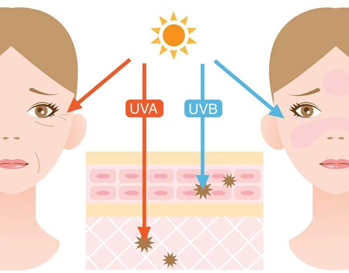 Không khí lạnh tràn về chị em nào bảo không cần bôi kem chống nắng thì nhầm to rồi
