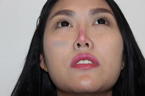 Khuôn mặt cứng đơ năm lần bảy lượt biến dạng khiến mỹ nhân việt vướng nghi vấn pttm