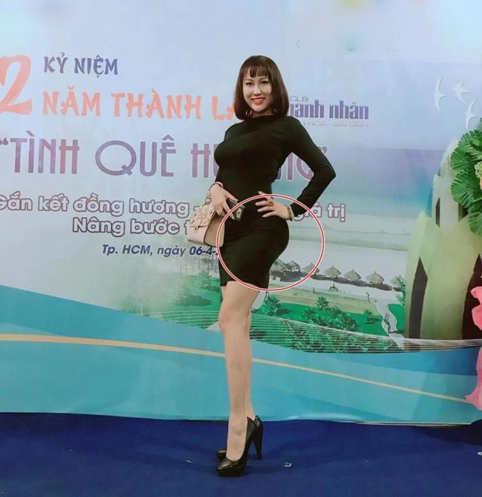 Kỷ lục những lần dao kéo nghe qua thấy thót tim của các nữ hoàng thẩm mỹ việt