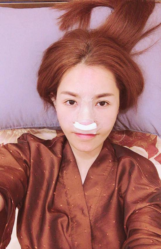 Kỷ lục những lần dao kéo nghe qua thấy thót tim của các nữ hoàng thẩm mỹ việt