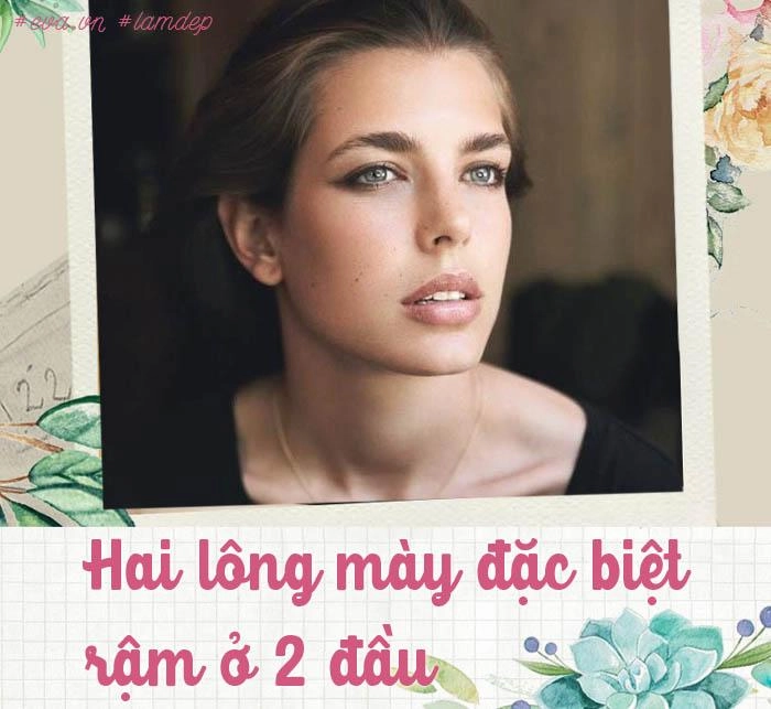 Làm đẹp kiểu hoàng gia người phải ăn uống kham khổ người sử dụng cả nọc ong