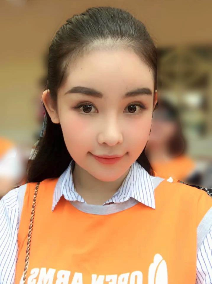 Lên tiếng trước nghi vấn bơm mặt hoa hậu lê âu ngân anh khi nào thì mới hết thị phi