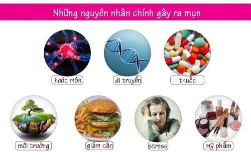 Mặt như vừng cơm cháy cũng nhẵn mịn ngay với 3 cách trị mụn trứng cá chưa đến 5 ngàn