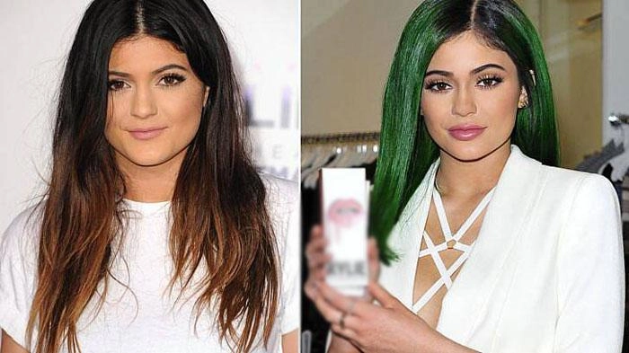mẹ đẻ trào lưu môi tều đã rút sạch filler sao việt chạy theo phong trào này giờ ra sao