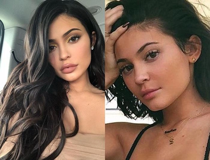 mẹ đẻ trào lưu môi tều đã rút sạch filler sao việt chạy theo phong trào này giờ ra sao