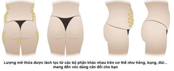 Muốn mông tấn công với số đo khủng đây là những phương pháp thẩm mỹ bạn cần biết