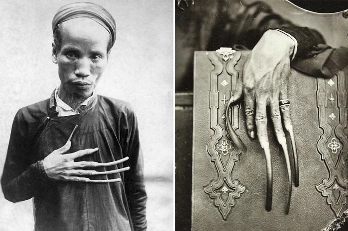 Muôn vàn cách làm đẹp ghê rợn thời trung cổ chỉ dám đọc chứ không dám thử