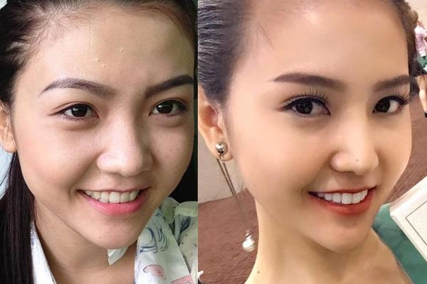 Mỹ nữ vũng tàu đi siêu xe 70 tỷ lộ ảnh cũ 5 năm trước bị tố dao kéo