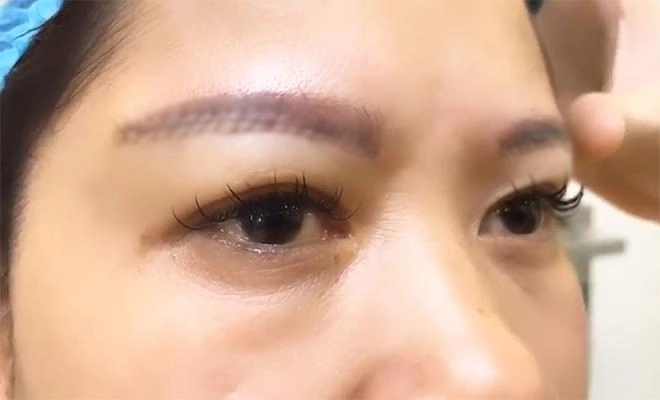 Nâng chân mày xong các nàng cần lưu ý những điều gì