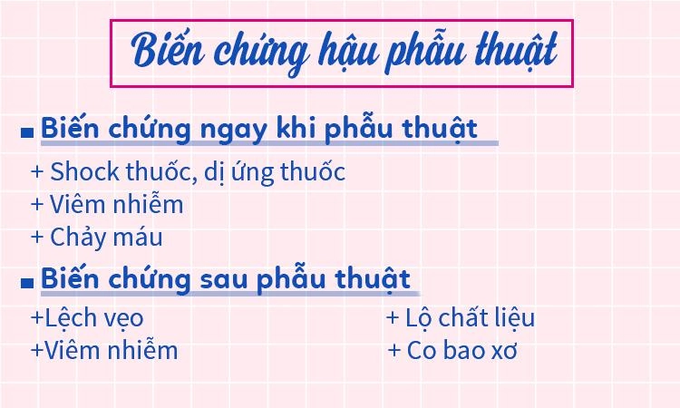 Nâng mũi s-line và những điều bạn cần biết trước khi quyết định bước làm đẹp này
