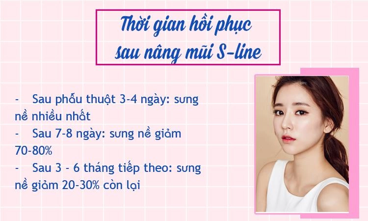 Nâng mũi s-line và những điều bạn cần biết trước khi quyết định bước làm đẹp này