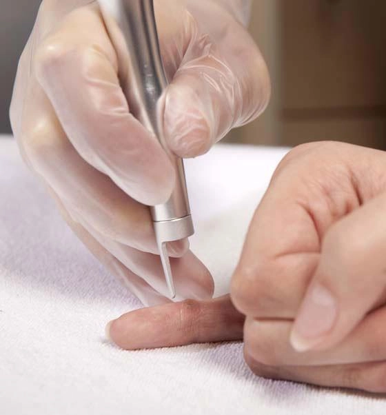 Nếu còn chưa biết mụn cóc có nguy hiểm không thì hãy cập nhật ngay các kiến thức này
