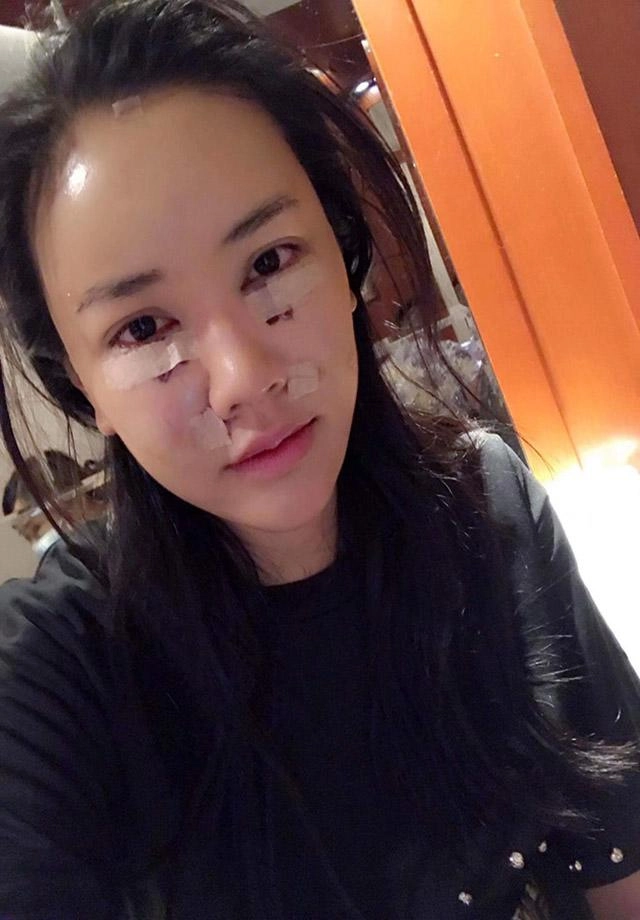 Nếu không nói liệu ai sẽ nhận ra các mỹ nhân này đã đụng chạm dao kéo chứ