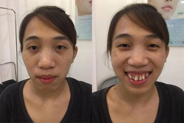 Ngỡ ngàng trước những ca đập đi xây lại kì diệu chẳng thua kém phượng thị nở
