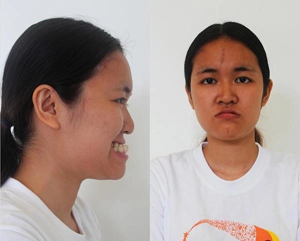 Ngỡ ngàng trước những ca đập đi xây lại kì diệu chẳng thua kém phượng thị nở