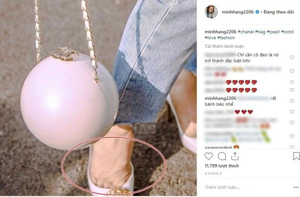 Ngoài chiếc cằm gây hốt hoảng fan còn chú ý khuyết điểm này của minh hằng