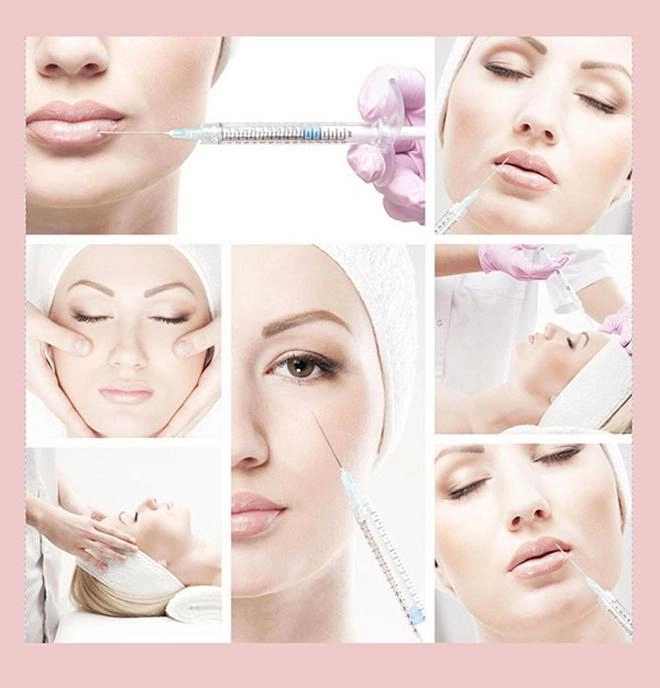 Nhẹ nhàng không đau không chảy máu bảo sao người người nhà nhà dẫn nhau đi tiêm filler