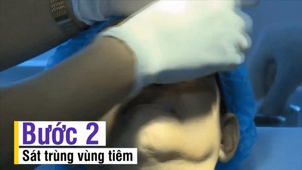 Nhẹ nhàng không đau không chảy máu bảo sao người người nhà nhà dẫn nhau đi tiêm filler
