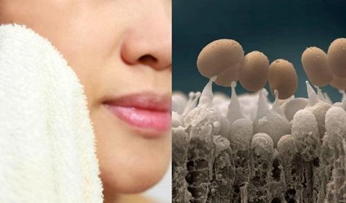 Những sai lầm ngày nào cũng mắc khiến mặt bạn ngày càng nhiều mụn hơn