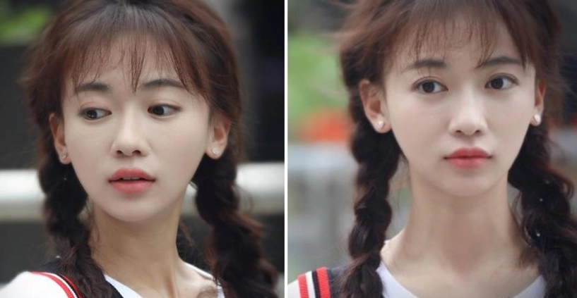 Nổi tiếng chưa lâu ngụy anh lạc bị tố độn cằm lộ ảnh quá khứ khác xa hiện tại
