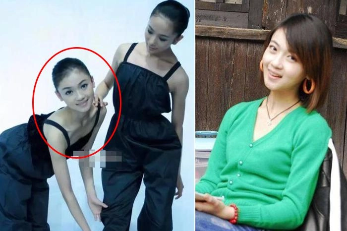 Nổi tiếng chưa lâu ngụy anh lạc bị tố độn cằm lộ ảnh quá khứ khác xa hiện tại
