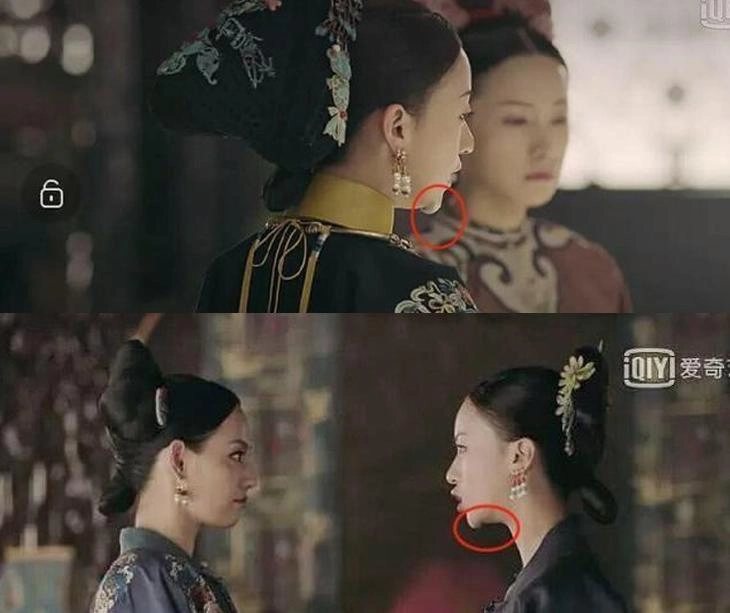 Nổi tiếng chưa lâu ngụy anh lạc bị tố độn cằm lộ ảnh quá khứ khác xa hiện tại