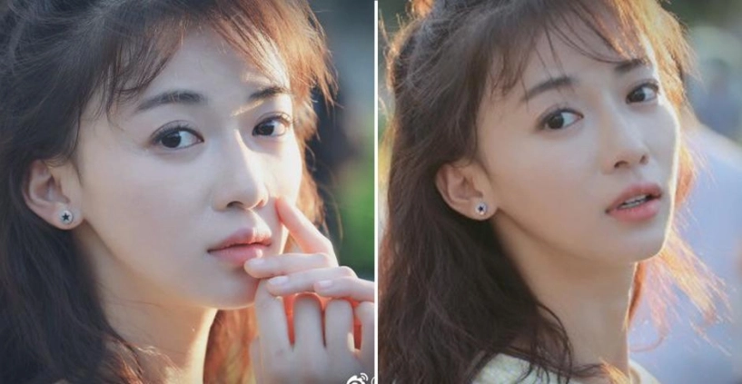 Nổi tiếng chưa lâu ngụy anh lạc bị tố độn cằm lộ ảnh quá khứ khác xa hiện tại