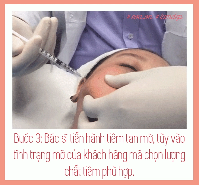Nọng cằm mỡ bắp tay mỡ bụng tan biến sau vài phút nhờ tiêm tan mỡ thực hư ra sao