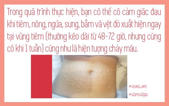 Nọng cằm mỡ bắp tay mỡ bụng tan biến sau vài phút nhờ tiêm tan mỡ thực hư ra sao