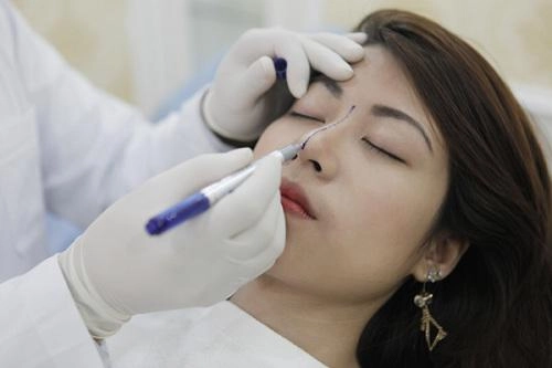 Phẫu thuật nâng mũi có ảnh hưởng gì không đọc bài viết dưới đây bạn sẽ rõ