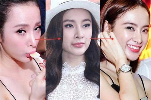 Phẫu thuật nâng mũi có ảnh hưởng gì không đọc bài viết dưới đây bạn sẽ rõ