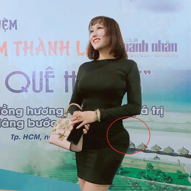 Phi thanh vân lộ vòng 3 méo mó sau một năm trải qua ca đại phẫu thuật lột xác