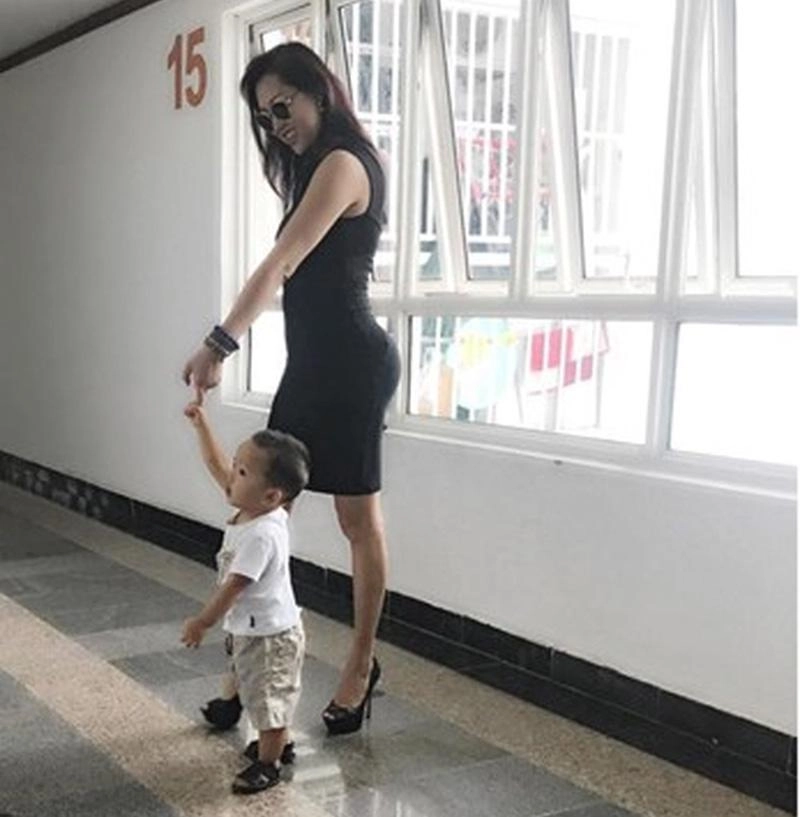 Phi thanh vân lộ vòng 3 méo mó sau một năm trải qua ca đại phẫu thuật lột xác