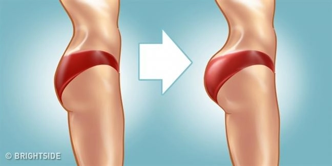 Phương pháp thẩm mỹ được loạt mỹ nhân lăng xê này lại gây chết người nhiều nhất thế giới