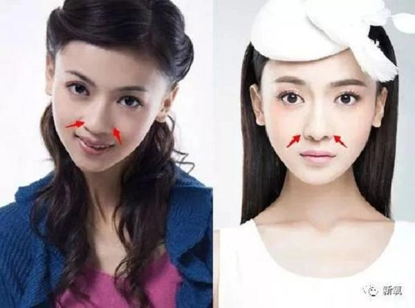 Quá xinh đẹp các mỹ nhân phim diên hy công lược bị bóc phốt phẫu thuật thẩm mỹ