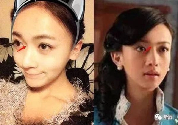 Quá xinh đẹp các mỹ nhân phim diên hy công lược bị bóc phốt phẫu thuật thẩm mỹ