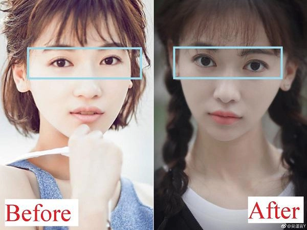 Quá xinh đẹp các mỹ nhân phim diên hy công lược bị bóc phốt phẫu thuật thẩm mỹ
