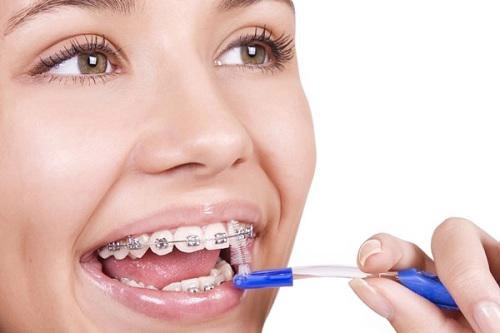 Răng sắt thì mặc răng sắt hoàng thùy khánh linh vẫn tự tin khoe nụ cười tỏa nắng