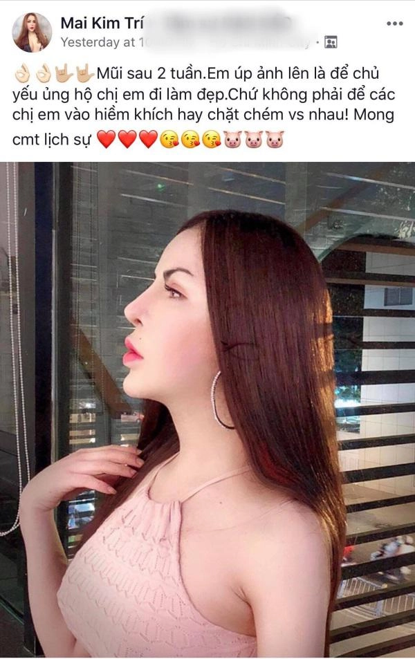 Sau biến chứng nạo silicone hot girl chuyển giới triệu followers tiếp tục khoe ảnh sửa mũi