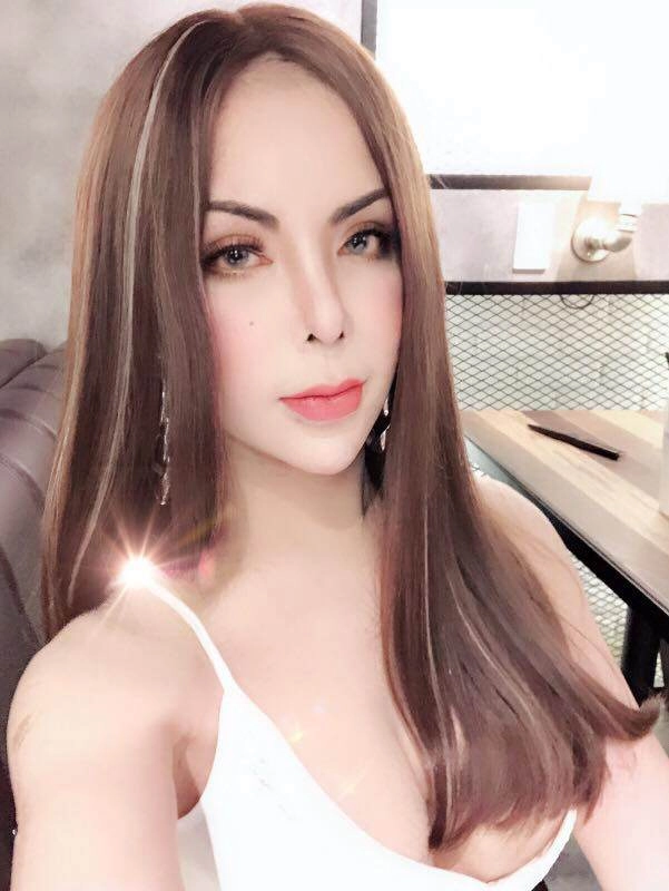 Sau biến chứng nạo silicone hot girl chuyển giới triệu followers tiếp tục khoe ảnh sửa mũi