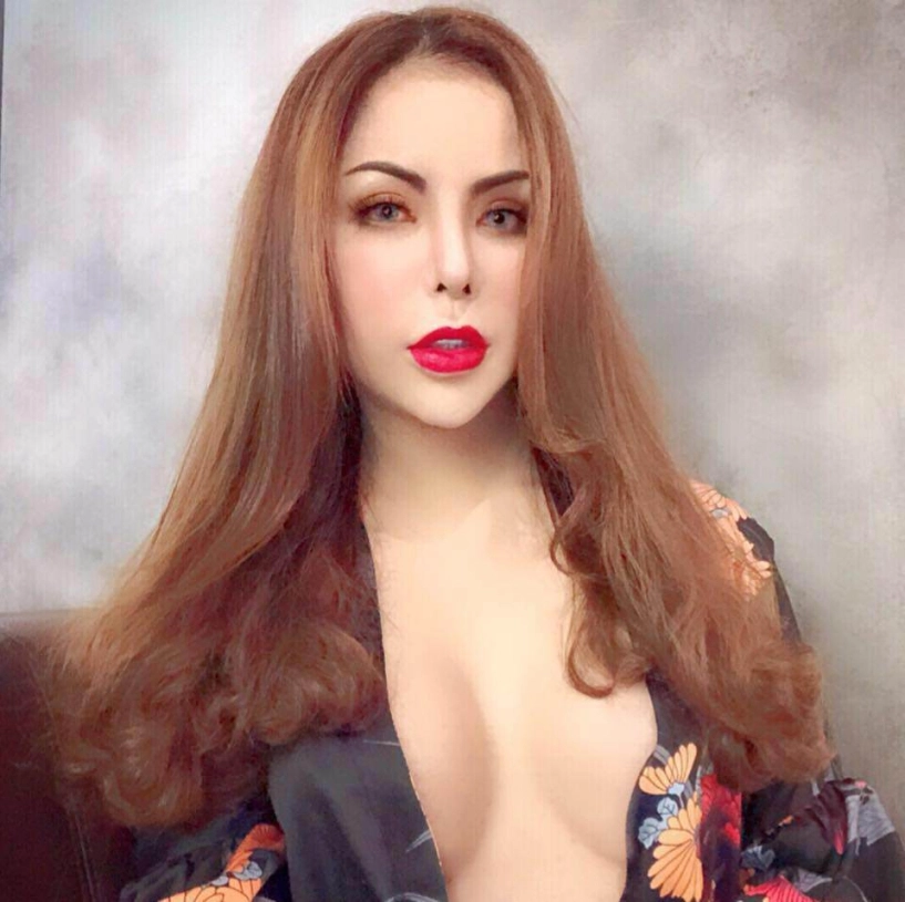 Sau biến chứng nạo silicone hot girl chuyển giới triệu followers tiếp tục khoe ảnh sửa mũi