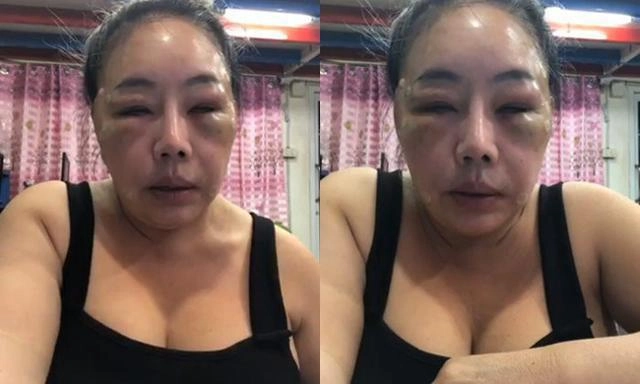 Sau nhiều cuộc trùng tu nhan sắc của đại gia 60 tuổi 14 đời chồng khiến nhiều người bật ngửa