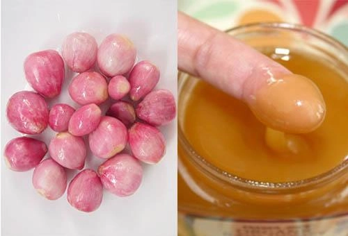 Sẹo thâm lâu năm cứng đầu đến mấy cũng phải đầu hàng với những mẹo dưới đây