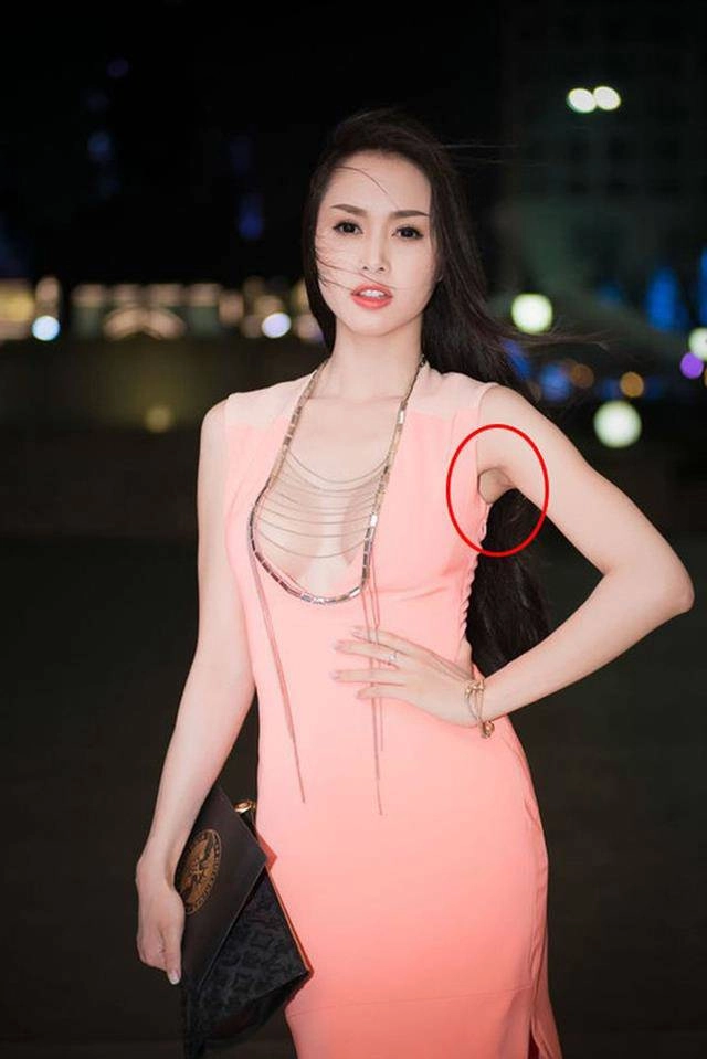 Sự thật đằng sau đôi gò bồng đảo căng tròn hết cỡ của thúy vi và loạt mỹ nhân việt