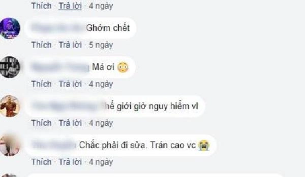 Sửa mũi cắt môi đã là gì chị em bây giờ còn rủ nhau đi cắt da đầu để
