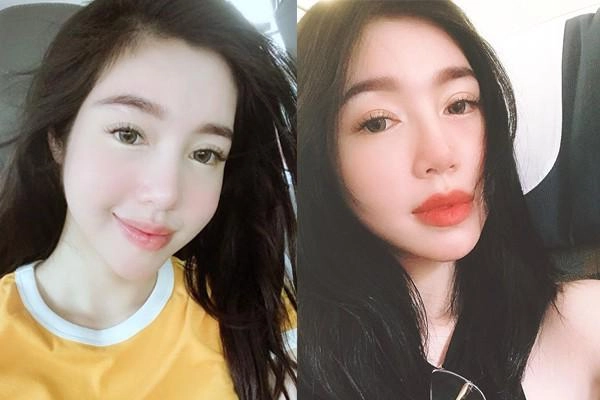 Tháng 7 bão tố hari won bị tố nâng mũi để giữ chồng minh hằng độn cằm biến dạng