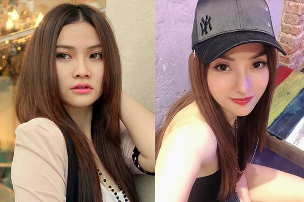 Tháng 7 bão tố hari won bị tố nâng mũi để giữ chồng minh hằng độn cằm biến dạng