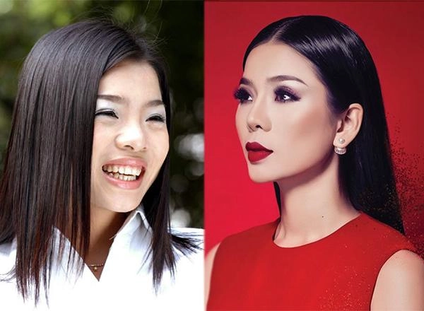 Tháo sụn mũi đã là gì đây mới là bước lên đời nhan sắc sáng suốt nhất của lệ quyên
