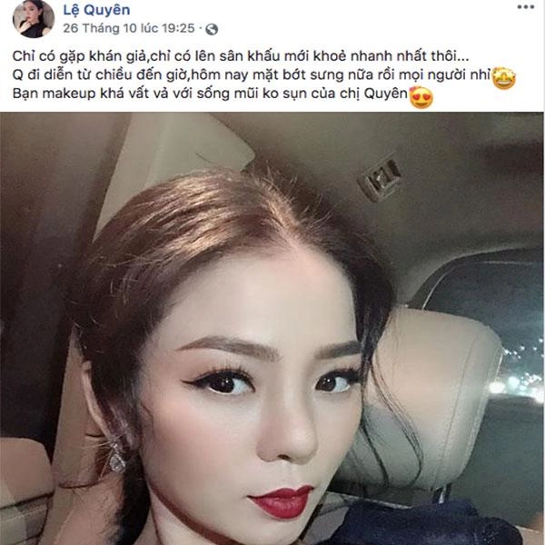Tháo sụn mũi vì sắp hoại tử nhưng lệ quyên lại được người hâm mộ khen hết lời